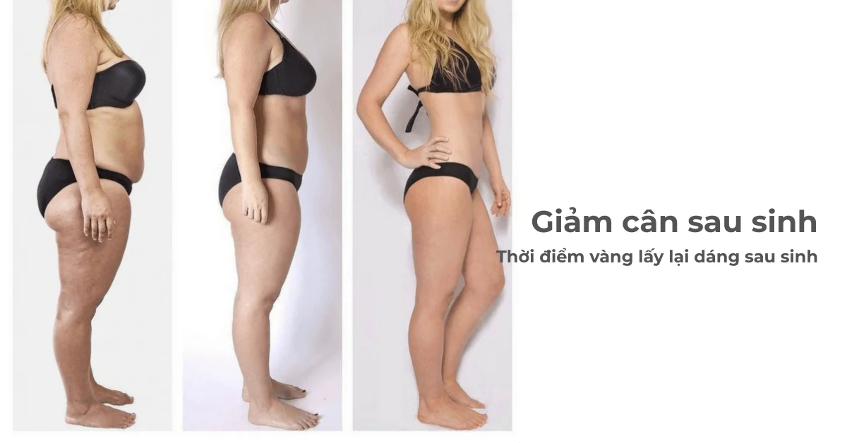 Giảm cân sau sinh - Khi nào là thời điểm vàng lấy lại dáng sau sinh?