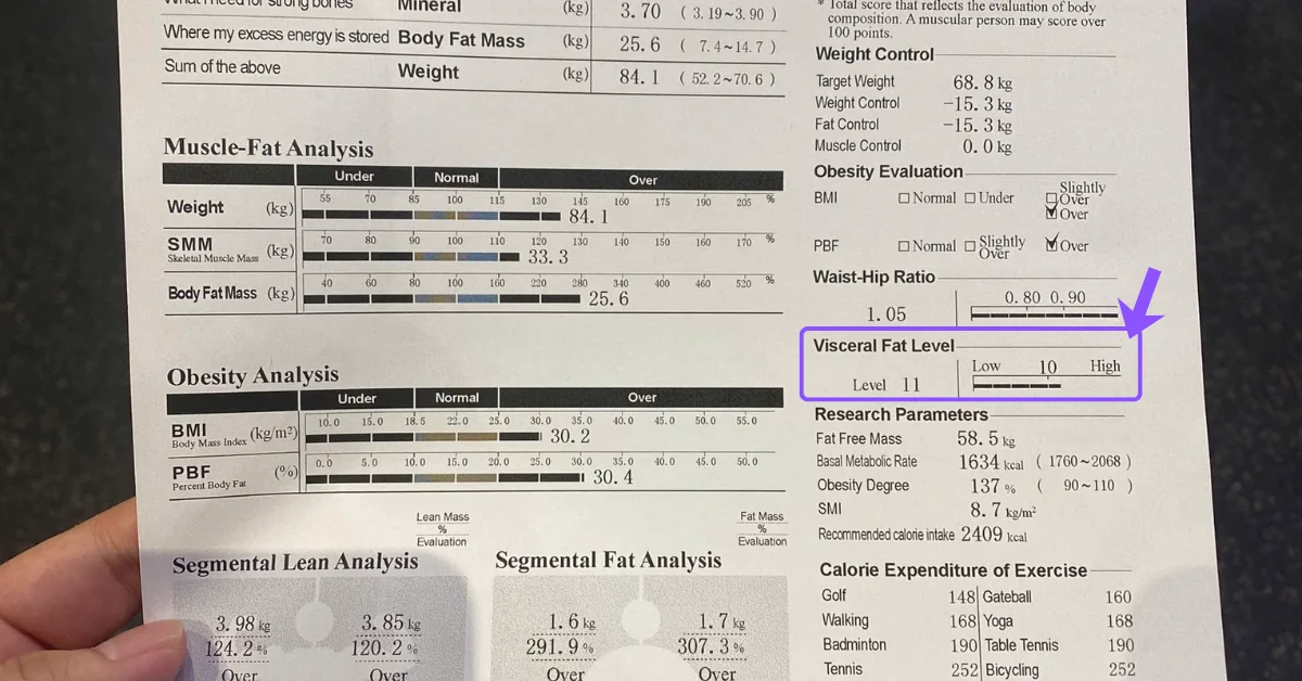 Visceral Fat Level (VFL)