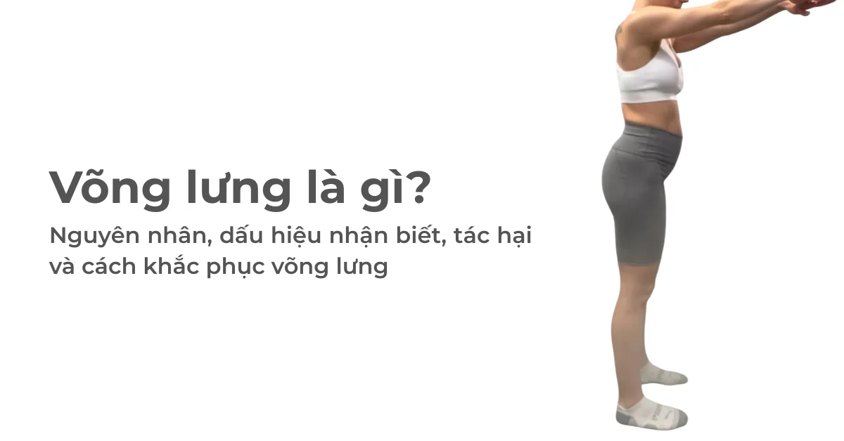 Võng lưng là gì? Nguyên nhân, dấu hiệu nhận biết, tác hại và cách khắc phục võng lưng